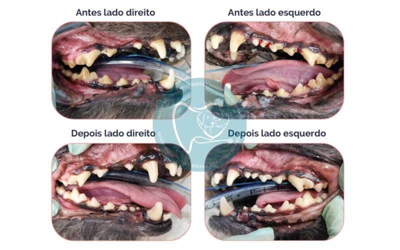 Tratamento Odontológico 3